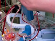 Acuzați că au obligat un bărbat să le doneze un rinichi și l-au ținut sclav